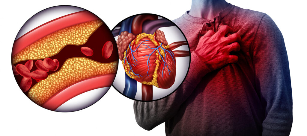 heart attack symptoms scaled